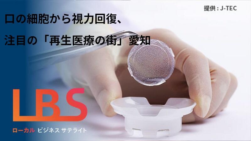 口の細胞から視力回復、注目の「再生医療の街」　愛知