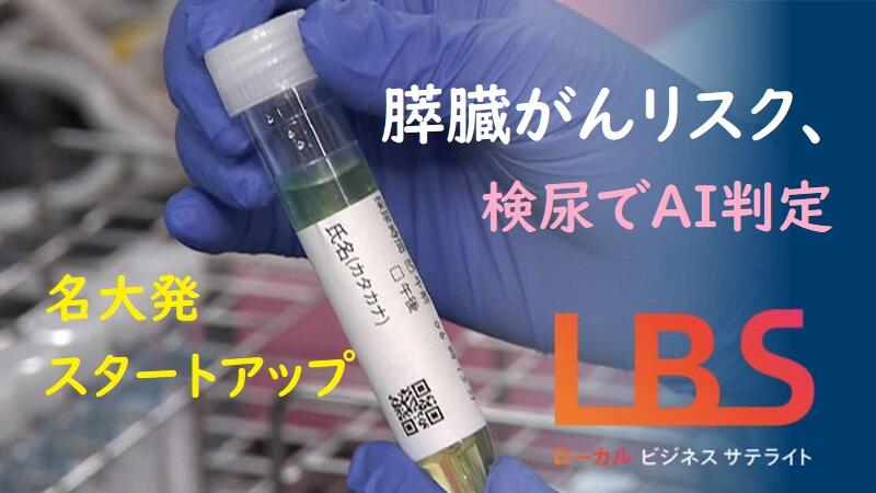 膵臓がんリスク、検尿でAI判定　名大発スタートアップ